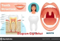 Diagram Gigi Sehat