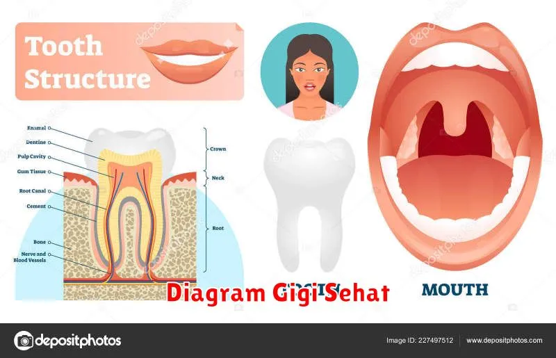 Diagram Gigi Sehat